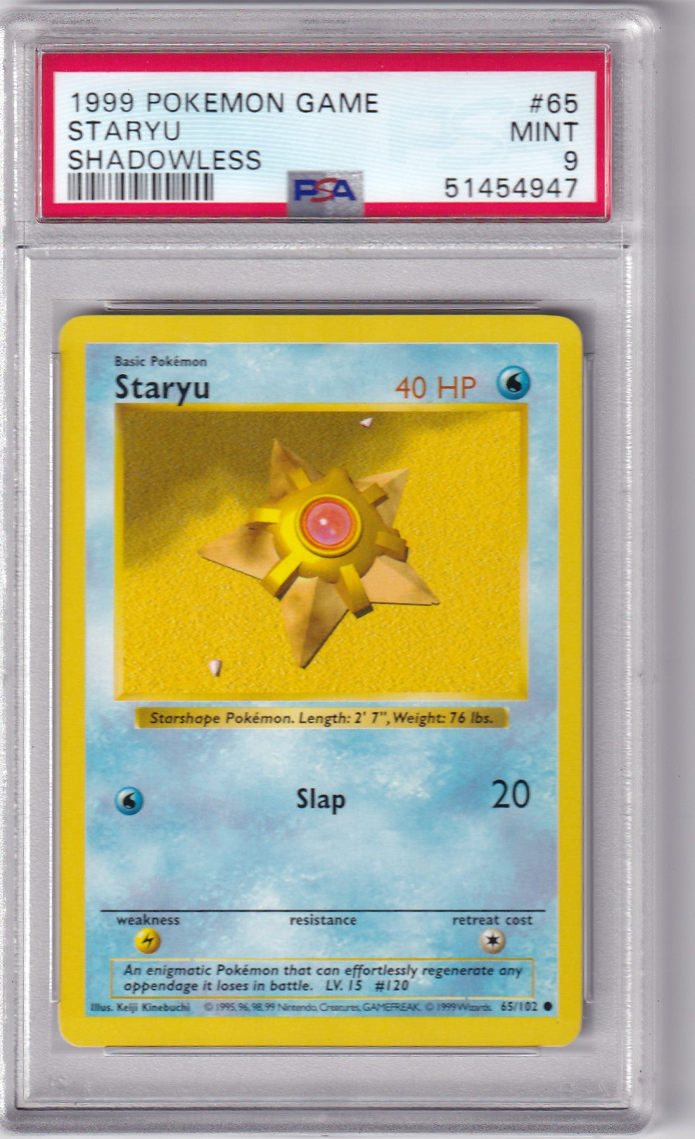 PSA 9 Staryu – Base Set #65/102 – Shadowless | Englisch